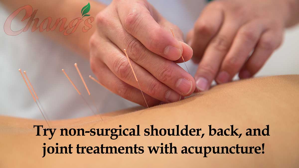 Acupuncture for Back Pain Relief
